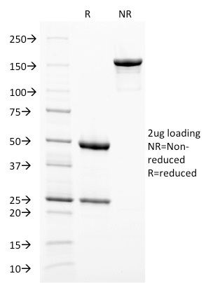 Data from SDS-PAGE analysis of Anti-gp100 antibody (Clone PMEL/2038). Reducing lane (R) shows heavy and light chain fragments. NR lane shows intact antibody with expected MW of approximately 150 kDa. The data are consistent with a high purity, intact mAb.